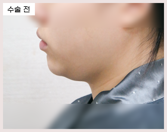 전사진